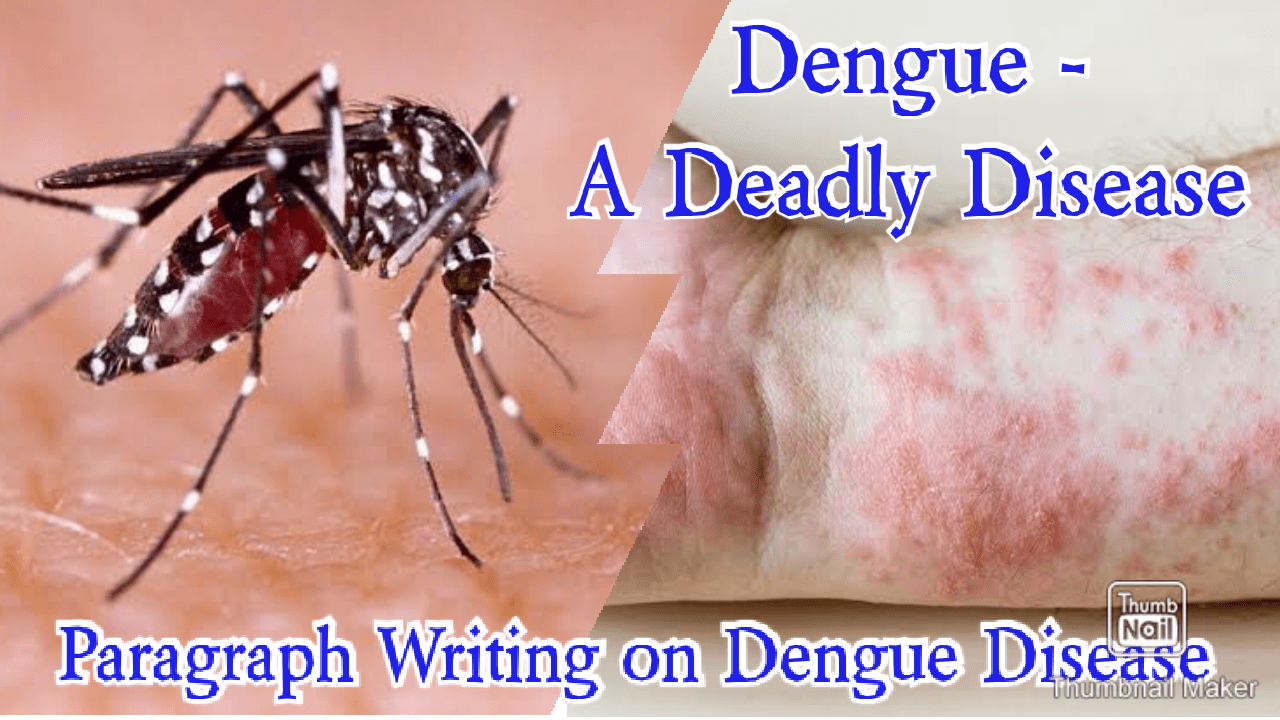 dengue essay in english 150 words